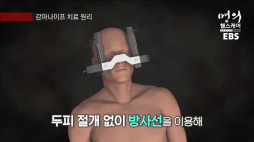 명의_(뇌종양)